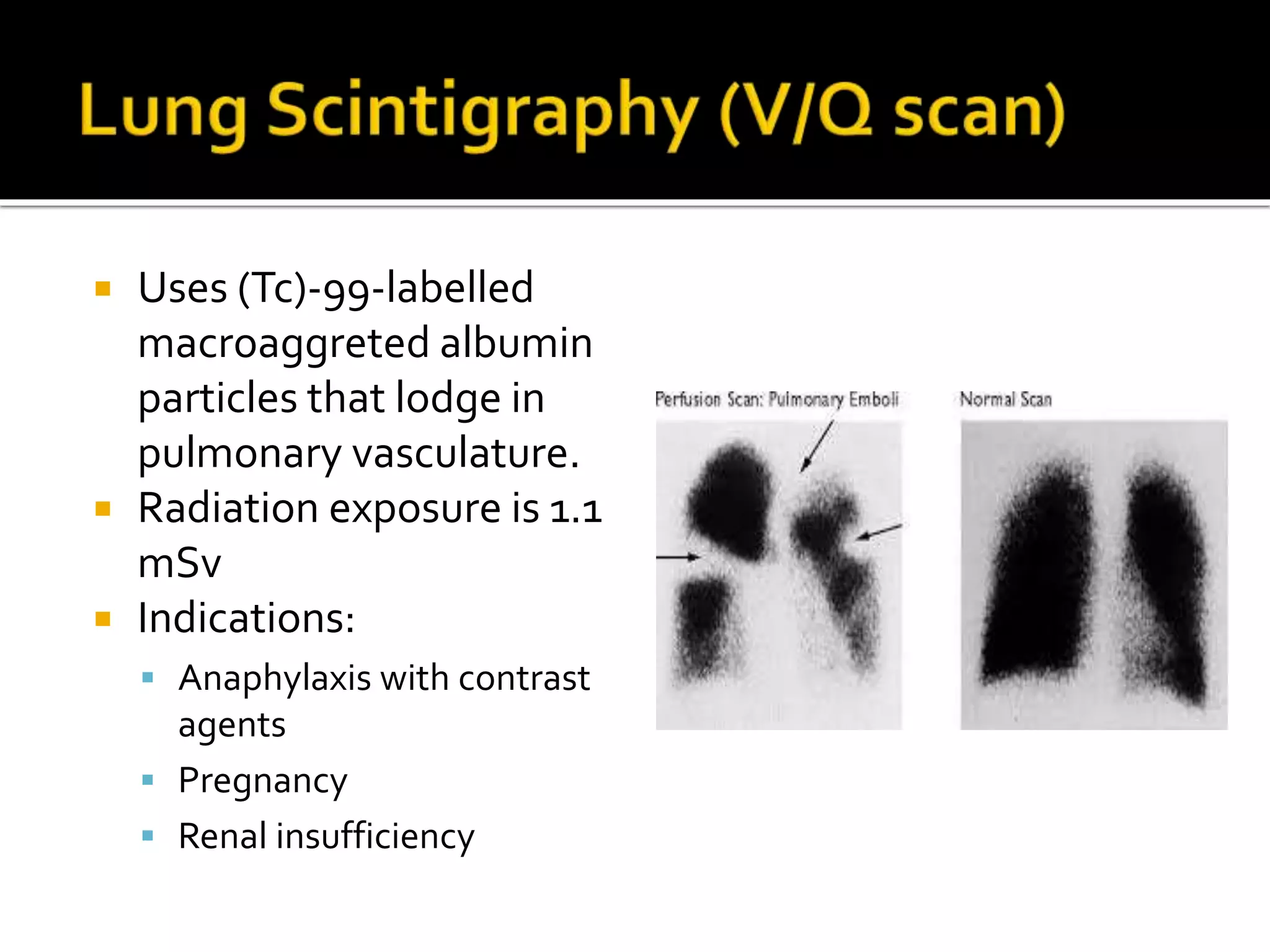 Principles of diagnosis & management of acute pulmonary | PPTX | Heart ...