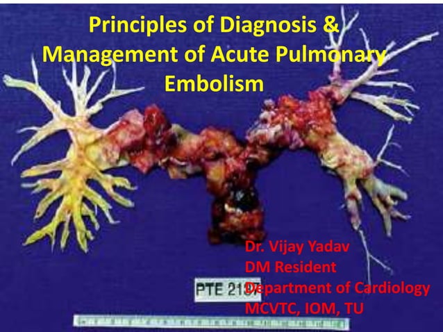 Principles of diagnosis & management of acute pulmonary | PPTX | Heart ...