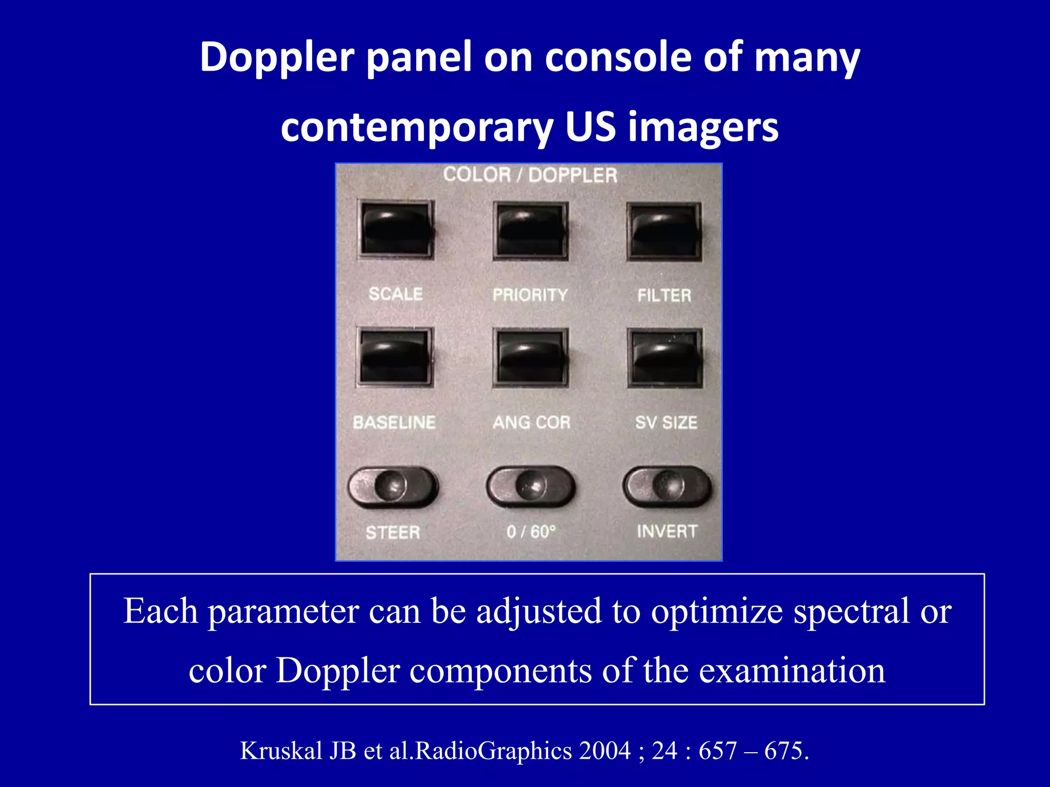Doppler panel on console of many
contemporary US imagers
Each parameter can be adjusted to optimize spectral or
color Doppler components of the examination
Kruskal JB et al.RadioGraphics 2004 ; 24 : 657 – 675.
 