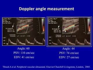 Principles of Doppler ultrasound