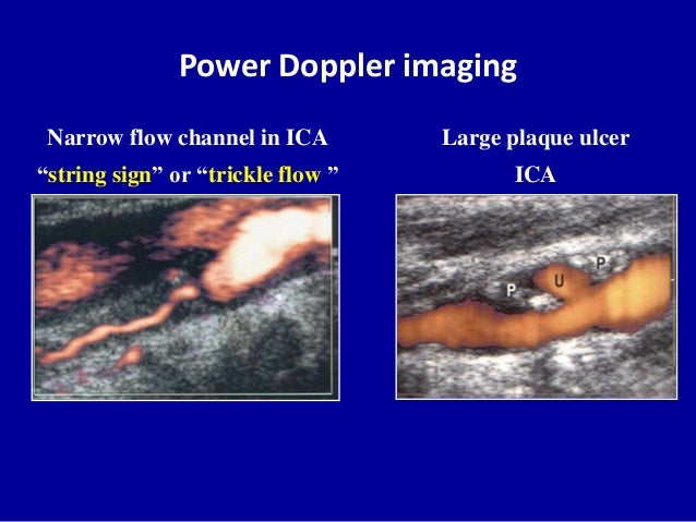 Principles of Doppler ultrasound