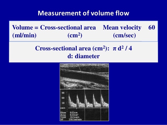 Principles of Doppler ultrasound