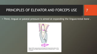 PRINCIPLES OF ELEVATOR AND FORCEPS USE
• Third, lingual or palatal pressure is aimed at expanding the linguocrestal bone .
7
 