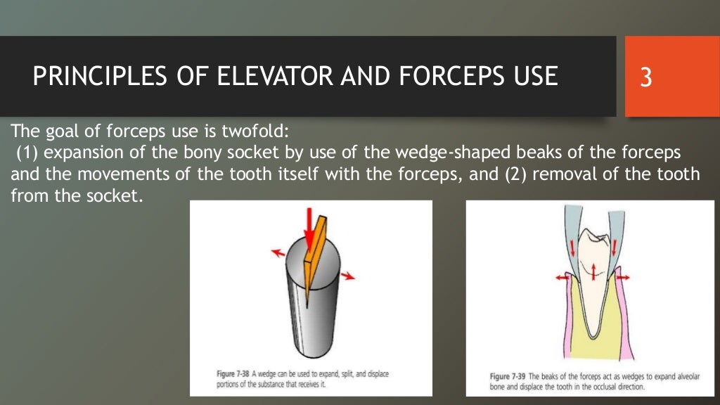 Principles of elevator and forceps use (Dentistry)