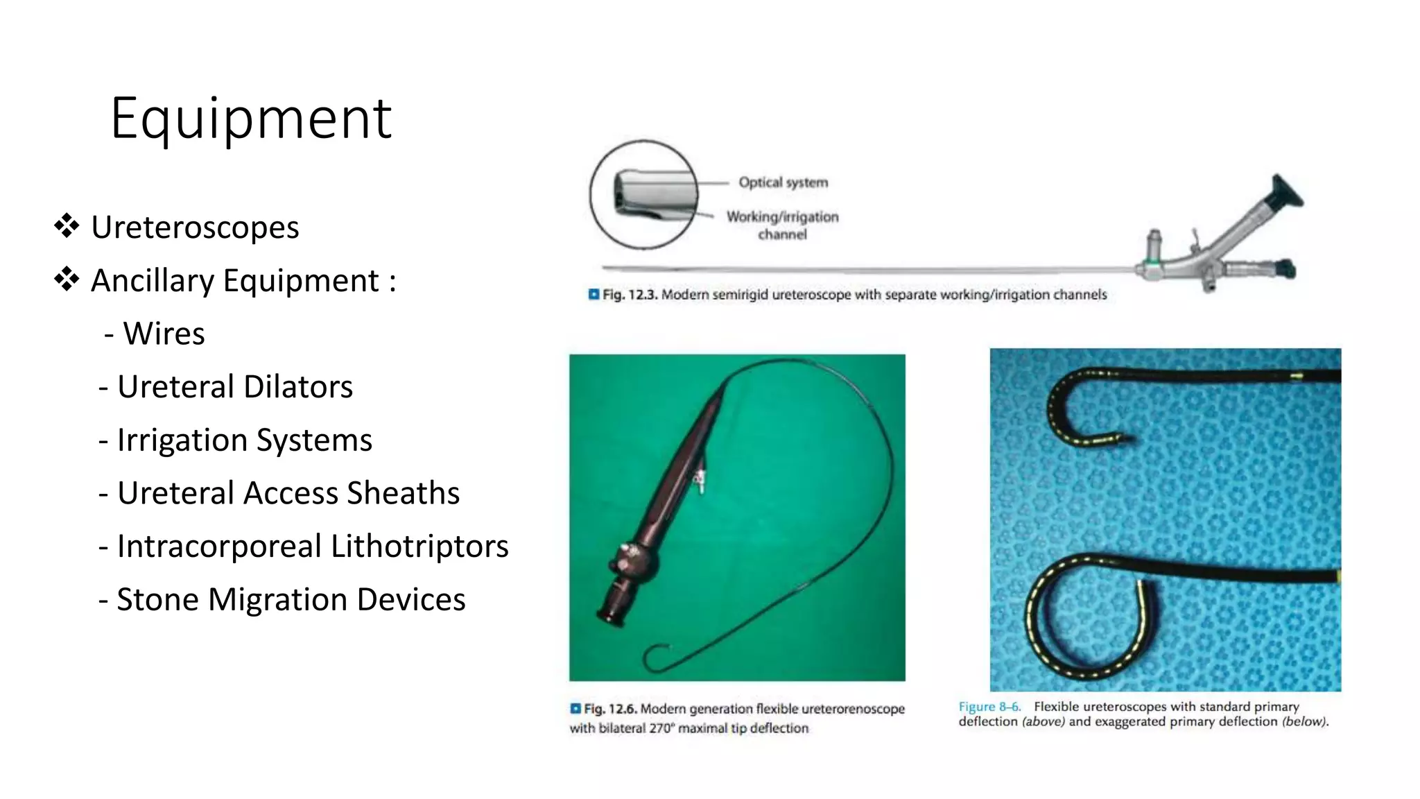 Equipment
 Ureteroscopes
 Ancillary Equipment :
- Wires
- Ureteral Dilators
- Irrigation Systems
- Ureteral Access Sheaths
- Intracorporeal Lithotriptors
- Stone Migration Devices
 