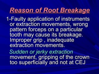 Principles of Exodontia | PPT