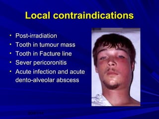 Local contraindications
• Post-irradiation
• Tooth in tumour mass
• Tooth in Facture line
• Sever pericoronitis
• Acute infection and acute

dento-alveolar abscess

20/01/14

 