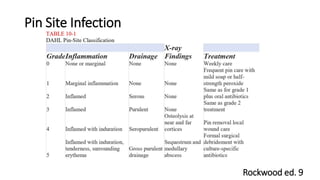 Principles of external fixation | PPTX