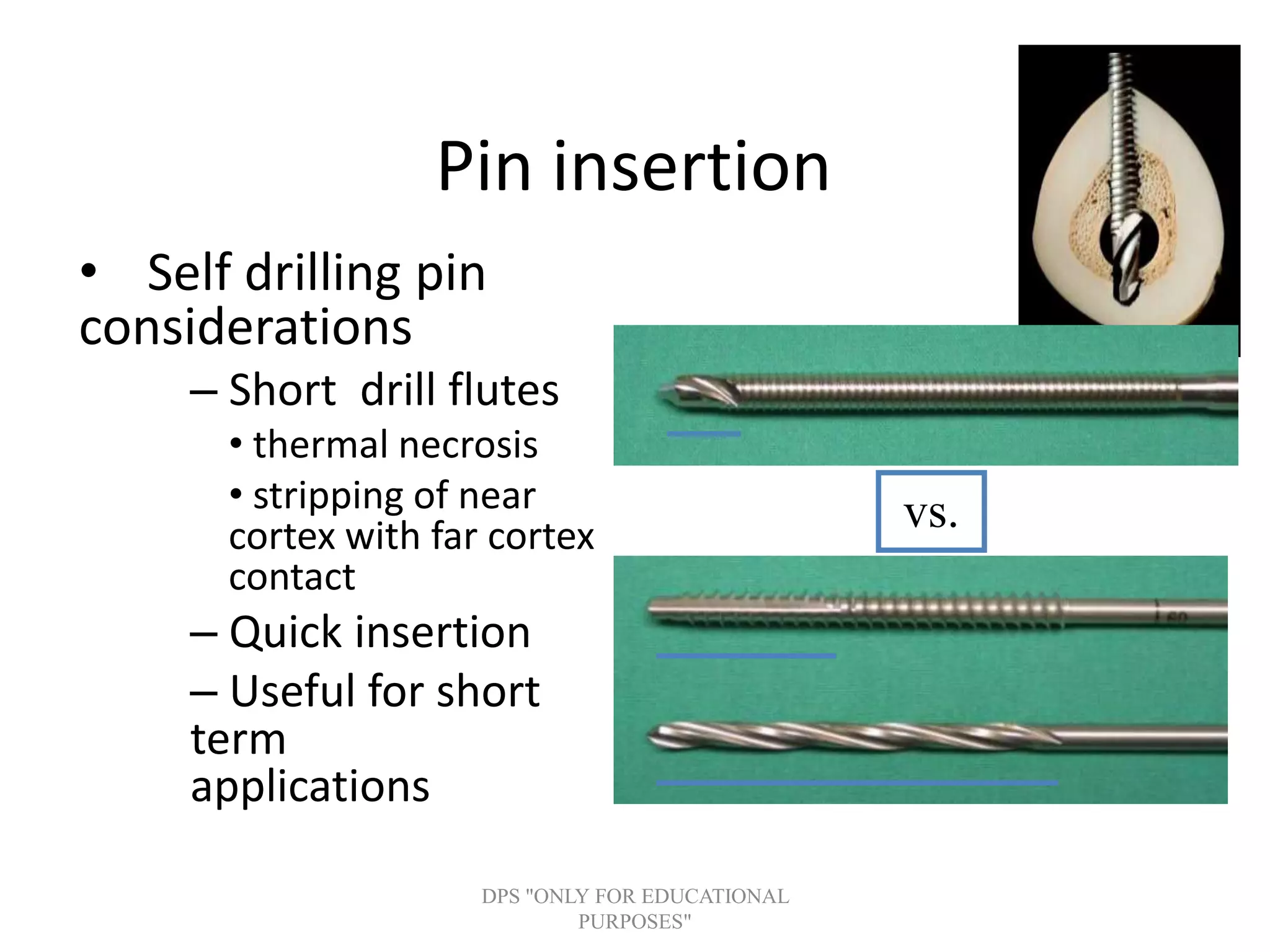 Pin insertion
• Self drilling pin
considerations
– Short drill flutes
• thermal necrosis
• stripping of near
cortex with far cortex
contact
– Quick insertion
– Useful for short
term
applications
vs.
DPS "ONLY FOR EDUCATIONAL
PURPOSES"
 