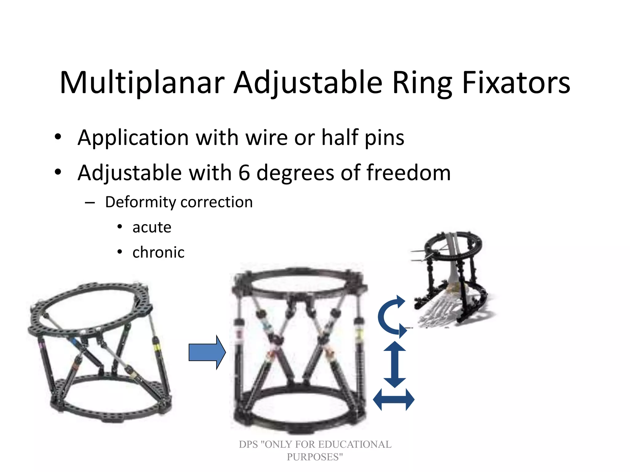 Multiplanar Adjustable Ring Fixators
• Application with wire or half pins
• Adjustable with 6 degrees of freedom
– Deformity correction
• acute
• chronic
DPS "ONLY FOR EDUCATIONAL
PURPOSES"
 