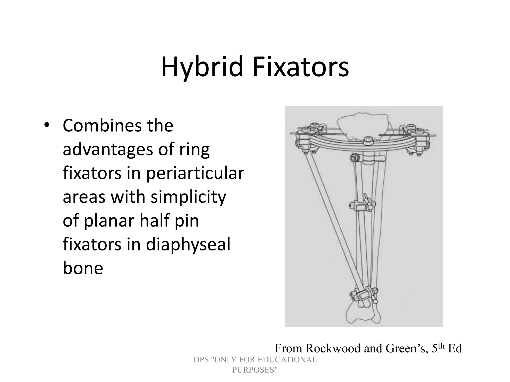 Hybrid Fixators
• Combines the
advantages of ring
fixators in periarticular
areas with simplicity
of planar half pin
fixators in diaphyseal
bone
From Rockwood and Green’s, 5th Ed
DPS "ONLY FOR EDUCATIONAL
PURPOSES"
 