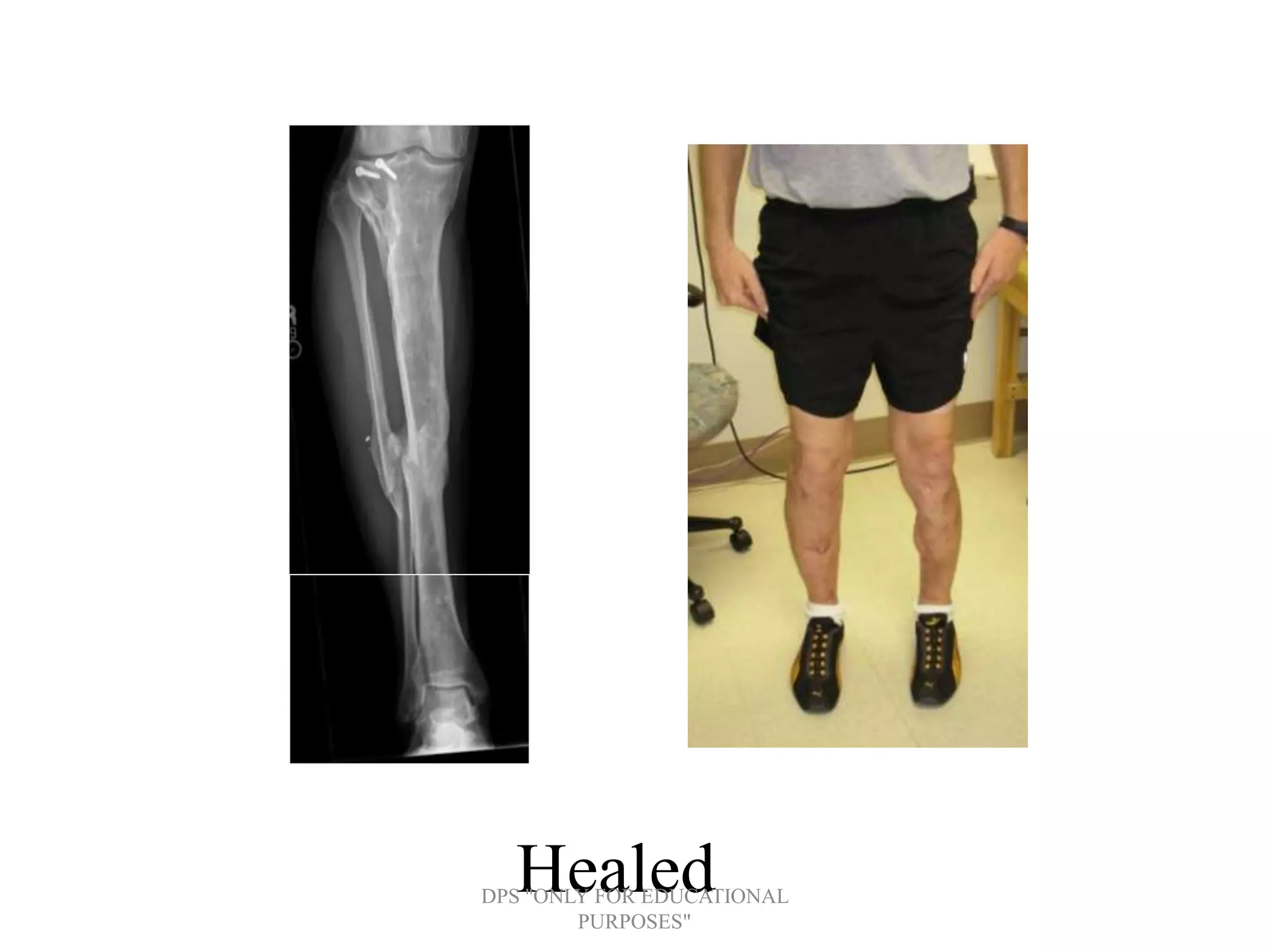 HealedDPS "ONLY FOR EDUCATIONAL
PURPOSES"
 