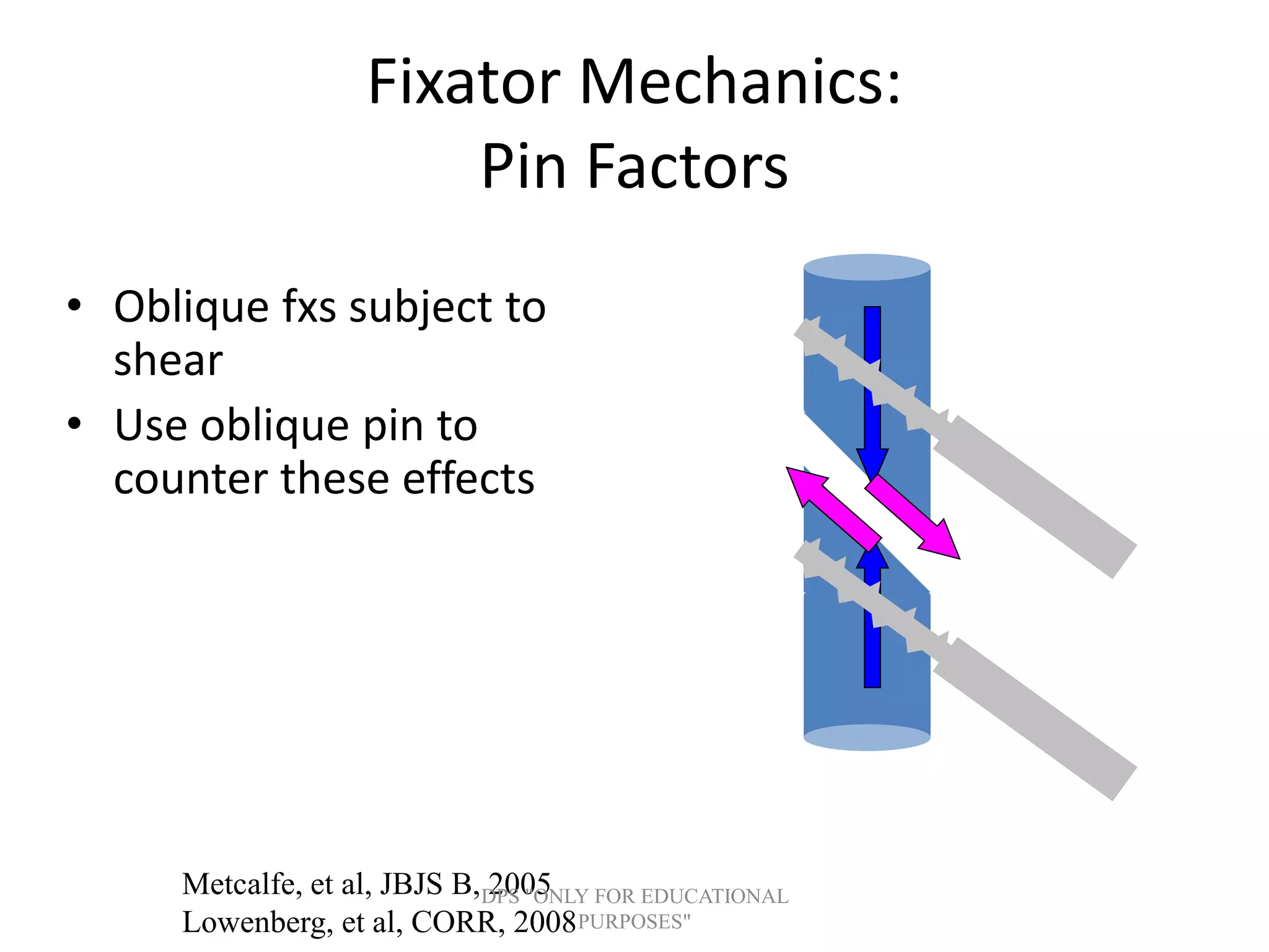 Fixator Mechanics:
Pin Factors
• Oblique fxs subject to
shear
• Use oblique pin to
counter these effects
Metcalfe, et al, JBJS B, 2005
Lowenberg, et al, CORR, 2008
DPS "ONLY FOR EDUCATIONAL
PURPOSES"
 