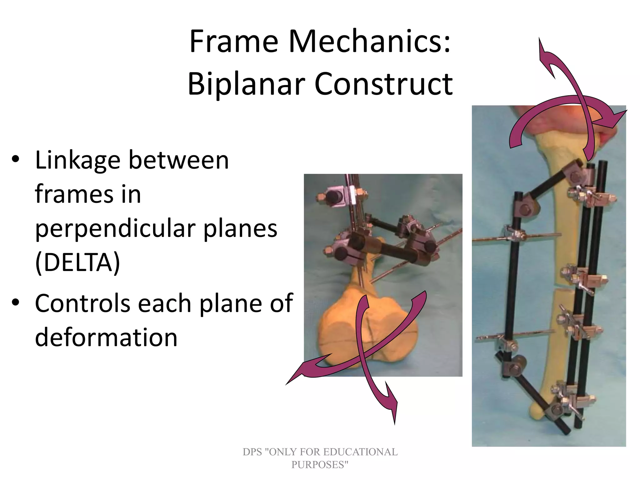 Frame Mechanics:
Biplanar Construct
• Linkage between
frames in
perpendicular planes
(DELTA)
• Controls each plane of
deformation
DPS "ONLY FOR EDUCATIONAL
PURPOSES"
 