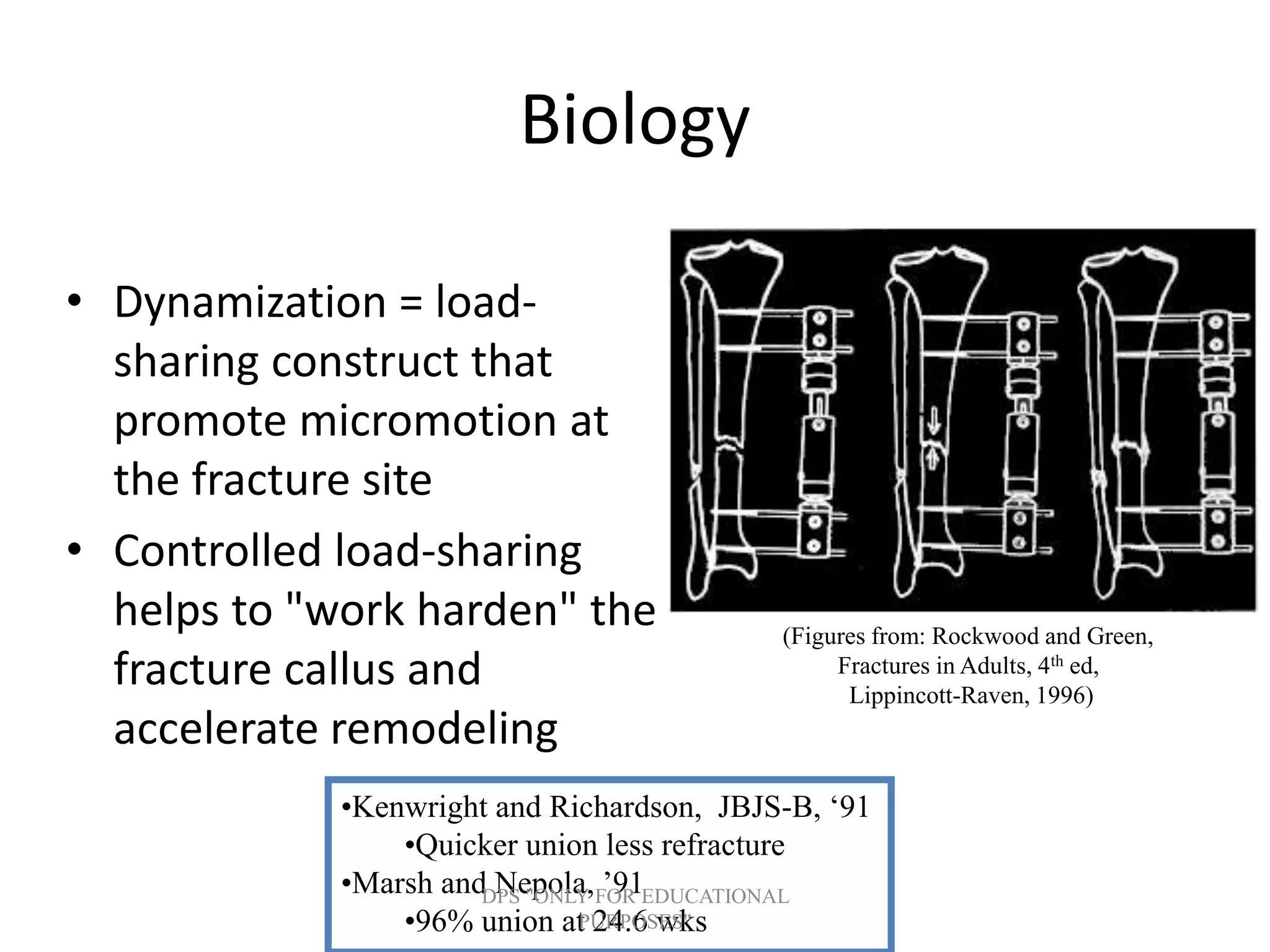 Biology
• Dynamization = load-
sharing construct that
promote micromotion at
the fracture site
• Controlled load-sharing
helps to "work harden" the
fracture callus and
accelerate remodeling
(Figures from: Rockwood and Green,
Fractures in Adults, 4th ed,
Lippincott-Raven, 1996)
•Kenwright and Richardson, JBJS-B, ‘91
•Quicker union less refracture
•Marsh and Nepola, ’91
•96% union at 24.6 wks
DPS "ONLY FOR EDUCATIONAL
PURPOSES"
 