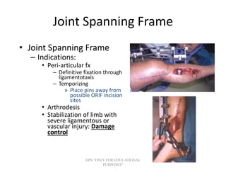 Principles External Fixator Principles of external fixator | PPT