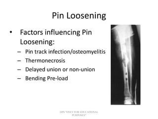 Pin Dissolution Principles of external fixator | PPT