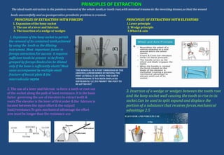 PRINCIPLES OF EXTRACTION
The ideal tooth extraction is the painless removal of the whole tooth,or tooth root,with minimal trauma to the investing tissues,so that the wound
heals uneventfully and no postoperative prosthetic problem is created.
PRINCIPLES OF EXTRACTION WITH FORCEPS PRINCIPLES OF EXTRACTION WITH ELEVATORS
1. Expansion of the bony socket 1.Lever principle
2. The use of a lever and fulcrum 2. Wedge principle
3. The insertion of a wedge or wedges 3.Wheel & axle
2. The use of a lever and fulcrum to force a tooth or root out
of the sochet along the path of least resistance. It is the basic
factor governing the use of elevators to extract teeth &
roots.The elevator is the lever of first order & the fulcrum is
located between the input effort & the outputl
load/resistance.To gain mechanical advantage the effort
arm must be longer than the resistance arm
1. Expansion of the bony socket to permit
the removal of its contained tooth,achieved
by using the tooth as the dilating
instrument .Most important factor in
forceps extraction.For success it requires
sufficient tooth be present to be firmly
grasped by forceps blades.Can be dilated
only if the bone is sufficiently elastic’.Most
cases accompanied by multiple small
fracture of buccal plate & the
interradicular septa.
3. Insertion of a wedge or wedges between the tooth root
and the bony socket wall causing the tooth to rise in its
socket.Can be used to split expand and displace the
portion of a substance that receives forces.mechanical
advantage 2.5
4.
THE REMOVAL OF A POST EMBEDDED IN THE
GROUND (A)PERFORMED BY MOVING THE
POST LATERALLY (B) UNTIL THE EARTH
SURROUNDING IT HAS BEEN DISPLACED
SUFFICIENTLY (C) TO PERMIT THE POST TO
BE LIFTED OUT
(A)
(B) (C)
 