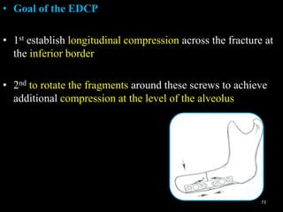 Principles of fixation and osteosynthesis in trauma | PPT