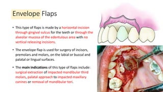 Principles of Flaps, Suturing and Management of difficult extraction.pdf