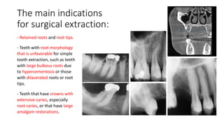Retained Roots's Extraction Principles of Flaps, Suturing and Management of difficult extraction.pdf