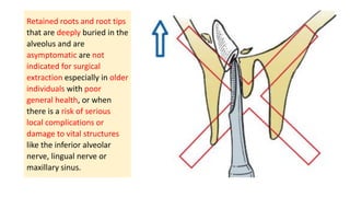 Retained Roots's Extraction Principles of Flaps, Suturing and Management of difficult extraction.pdf