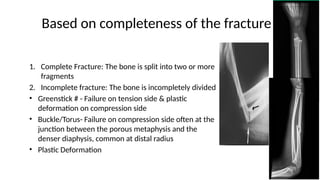Incomplete Break PRINCIPLES OF FRACTURE.pptx of medicine p | PPTX