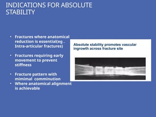 Comprehensive Principles and Techniques of Fracture Fixation in ...