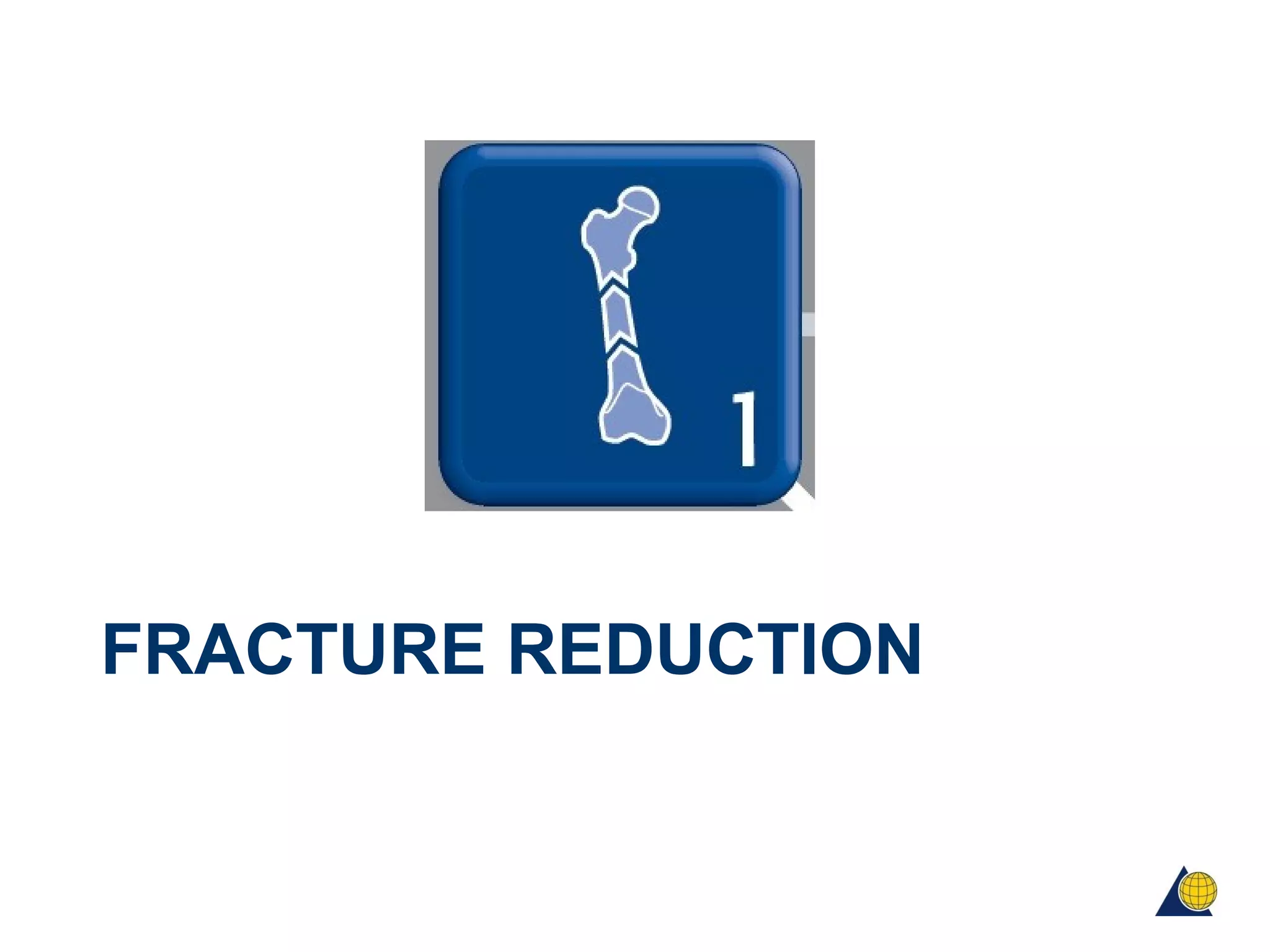 Principles of fracture fixation | PPT
