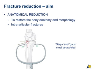 Principles of fracture fixation | PPT