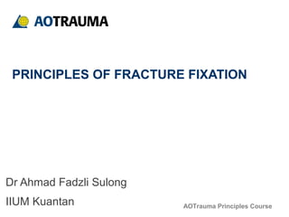 AOTrauma Principles Course
PRINCIPLES OF FRACTURE FIXATION
Dr Ahmad Fadzli Sulong
IIUM Kuantan
 