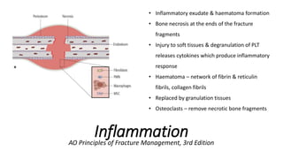 Principles of Fracture Management for General Surgeons.pptx