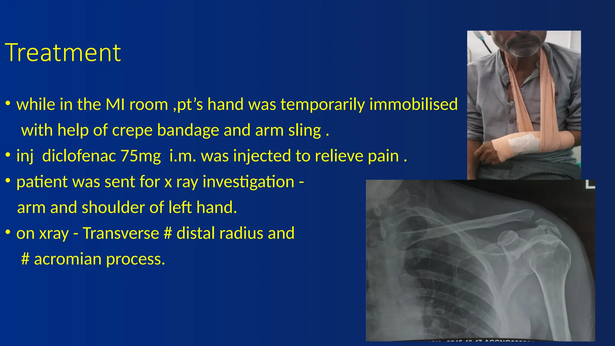 principles of fracture management by plaster cast.pptx
