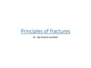 Principles of fractures
BY DR/ KHALED ALSAYANI
 