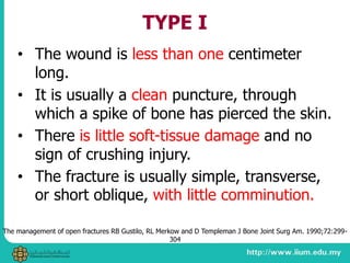 TYPE I
• The wound is less than one centimeter
long.
• It is usually a clean puncture, through
which a spike of bone has pierced the skin.
• There is little soft-tissue damage and no
sign of crushing injury.
• The fracture is usually simple, transverse,
or short oblique, with little comminution.
The management of open fractures RB Gustilo, RL Merkow and D Templeman J Bone Joint Surg Am. 1990;72:299-
304
 