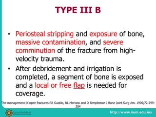 TYPE III B
• Periosteal stripping and exposure of bone,
massive contamination, and severe
comminution of the fracture from high-
velocity trauma.
• After debridement and irrigation is
completed, a segment of bone is exposed
and a local or free flap is needed for
coverage.
The management of open fractures RB Gustilo, RL Merkow and D Templeman J Bone Joint Surg Am. 1990;72:299-
304
 