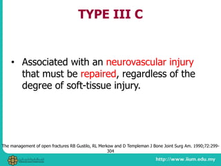 TYPE III C
• Associated with an neurovascular injury
that must be repaired, regardless of the
degree of soft-tissue injury.
The management of open fractures RB Gustilo, RL Merkow and D Templeman J Bone Joint Surg Am. 1990;72:299-
304
 