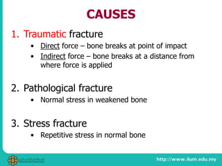 CAUSES
1. Traumatic fracture
• Direct force – bone breaks at point of impact
• Indirect force – bone breaks at a distance from
where force is applied
2. Pathological fracture
• Normal stress in weakened bone
3. Stress fracture
• Repetitive stress in normal bone
 
