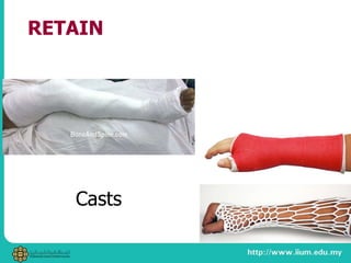 RETAIN
Casts
 