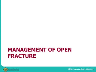 MANAGEMENT OF OPEN
FRACTURE
 