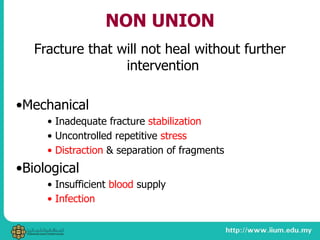 NON UNION
Fracture that will not heal without further
intervention
•Mechanical
• Inadequate fracture stabilization
• Uncontrolled repetitive stress
• Distraction & separation of fragments
•Biological
• Insufficient blood supply
• Infection
 