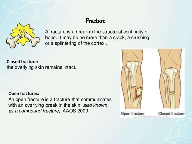 principles-of-fractures-management