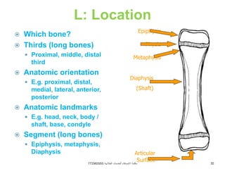 Principles of Fracture Treatment - 1.ppt