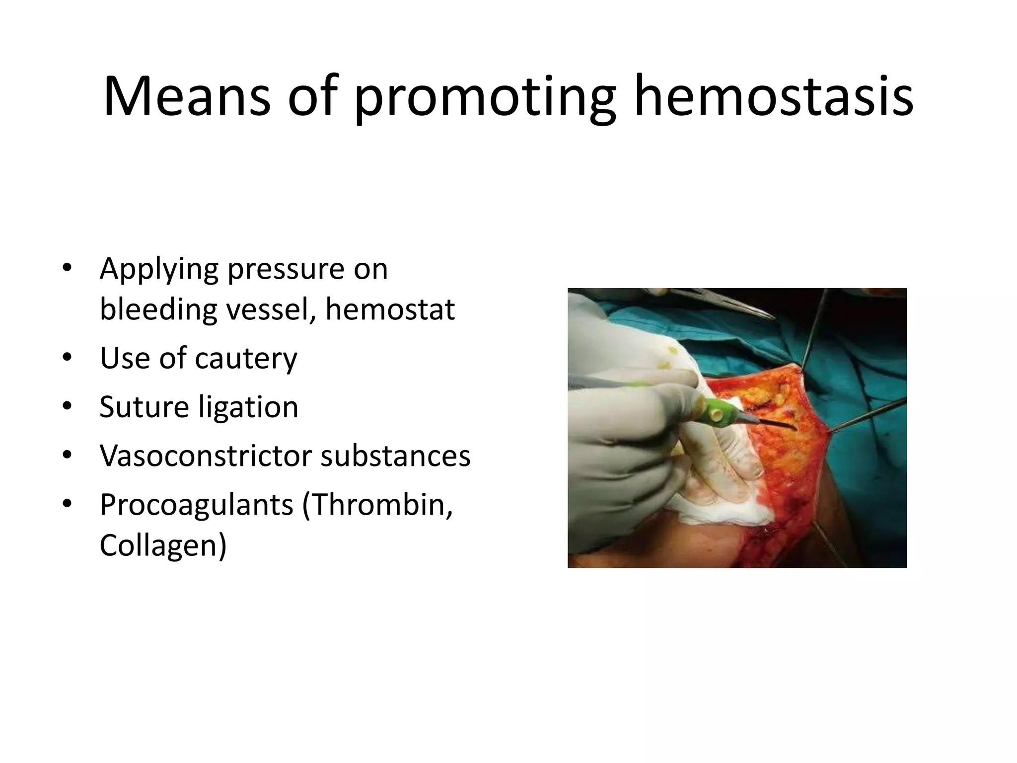 Means of promoting hemostasis
• Applying pressure on
bleeding vessel, hemostat
• Use of cautery
• Suture ligation
• Vasoconstrictor substances
• Procoagulants (Thrombin,
Collagen)
 