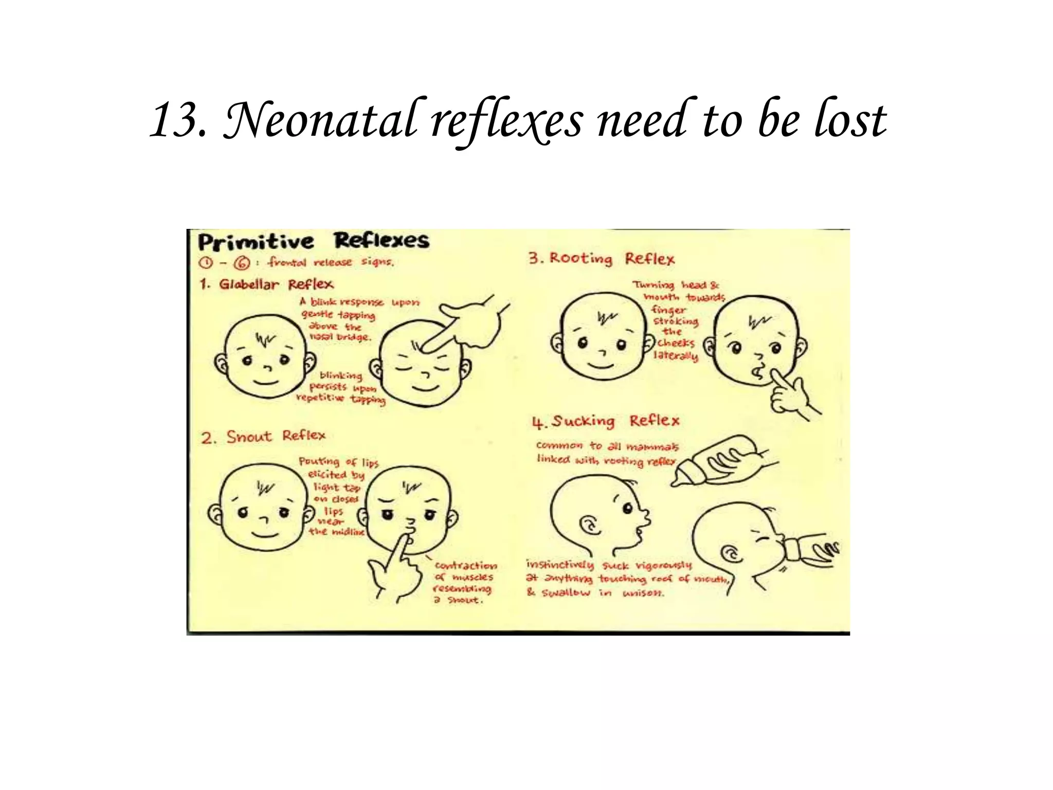 13. Neonatal reflexes need to be lost
 