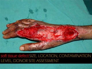soft tissue defect:SIZE, LOCATION, CONTAMINATION
LEVEL, DONOR SITE ASSESSMENT

 