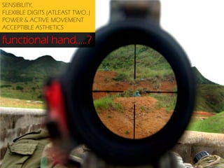 SENSIBILITY,
FLEXIBLE DIGITS (ATLEAST TWO..)
POWER & ACTIVE MOVEMENT
ACCEPTIBLE ASTHETICS

functional hand…..?

 