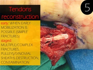 Tendons
reconstruction
early: WHEN EARLY
MOBILIZATION IS
POSSIBLE (SIMPLE
FRACTURES)
staged:
MULTIPLE/COMPLEX
FRACTURES,
PULLEYS/SYNOVIAL
SHEATHS DESTRUCTION,
CONTAMINATION

5

 