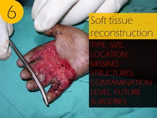 6

Soft tissue
reconstruction
TYPE, SIZE,
LOCATION,
MISSING
STRUCTURES,
CONTAMINATION
LEVEL, FUTURE
SURGERIES

 