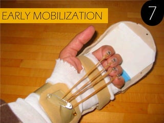 EARLY MOBILIZATION

7

 